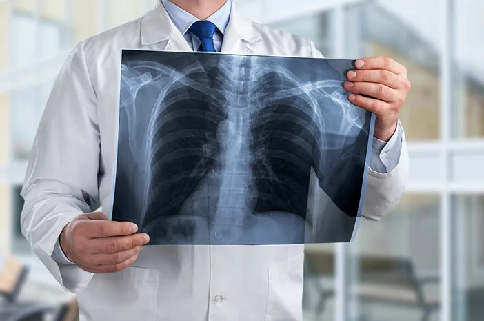 Room Radiologi