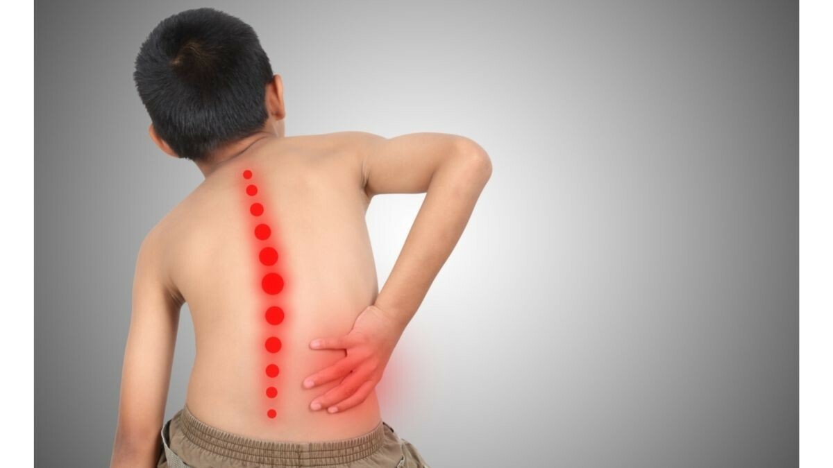 Skoliosis pada Anak